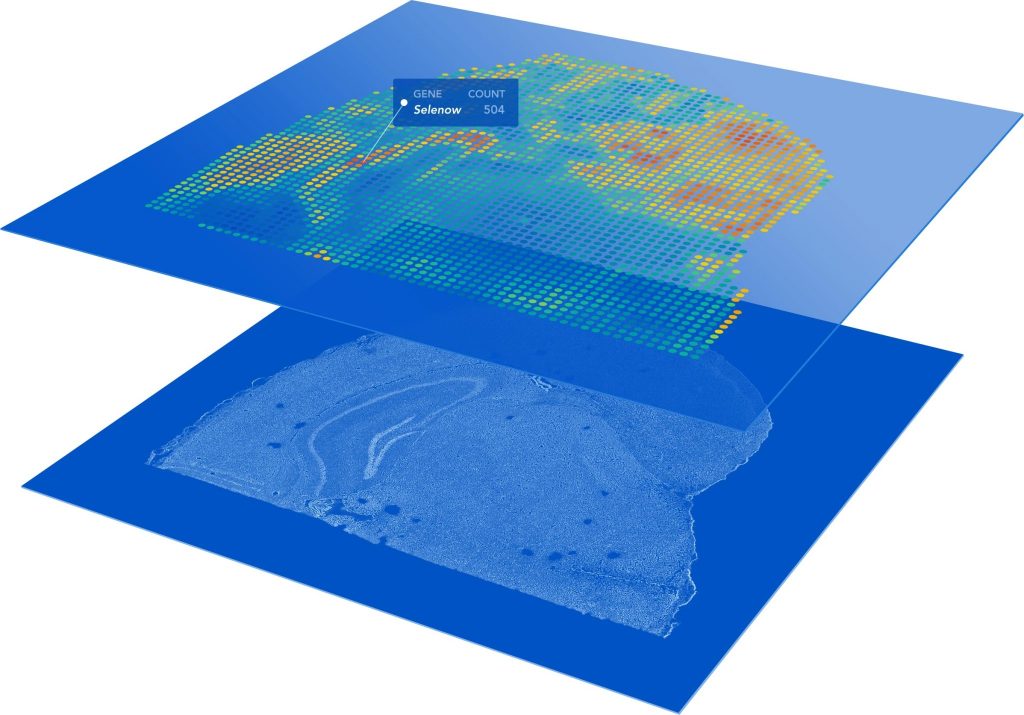 spatial-gene-expression-1